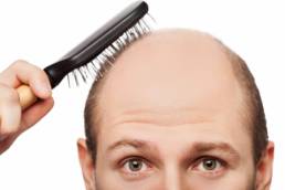 Hair Restoration - Clear Lake Medspa (1)